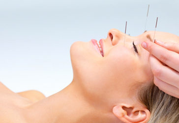 Where To Get Acupuncture During Pregnancy In Hong Kong?